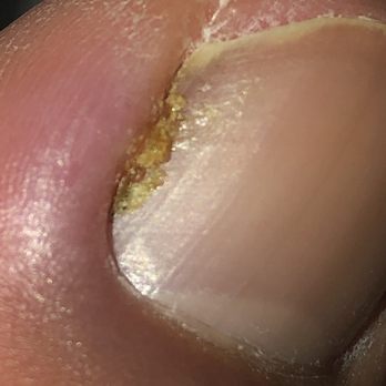 Le's O Nails - Got worse - Nail Salons Near Me - Oxnard, California