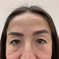 Bui Hoang MD - Before the surgery