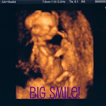 3DBabyVu - 15 weeks BIG SMILE! - Ultrasound Imaging Centers Near Me - Pleasanton, California 3DBabyVu - 15 weeks BIG SMILE! - Ultrasound Imaging Centers Near Me - Pleasanton, California