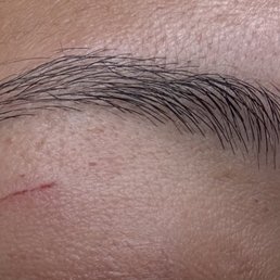 Right eye; scratches from threading Right eye; scratches from threading