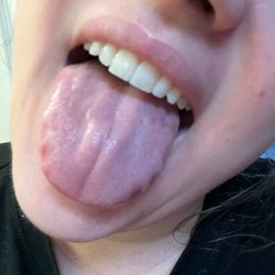 Mission Hills Family Dental - Perfect smile thanks to Dr Miller and team!