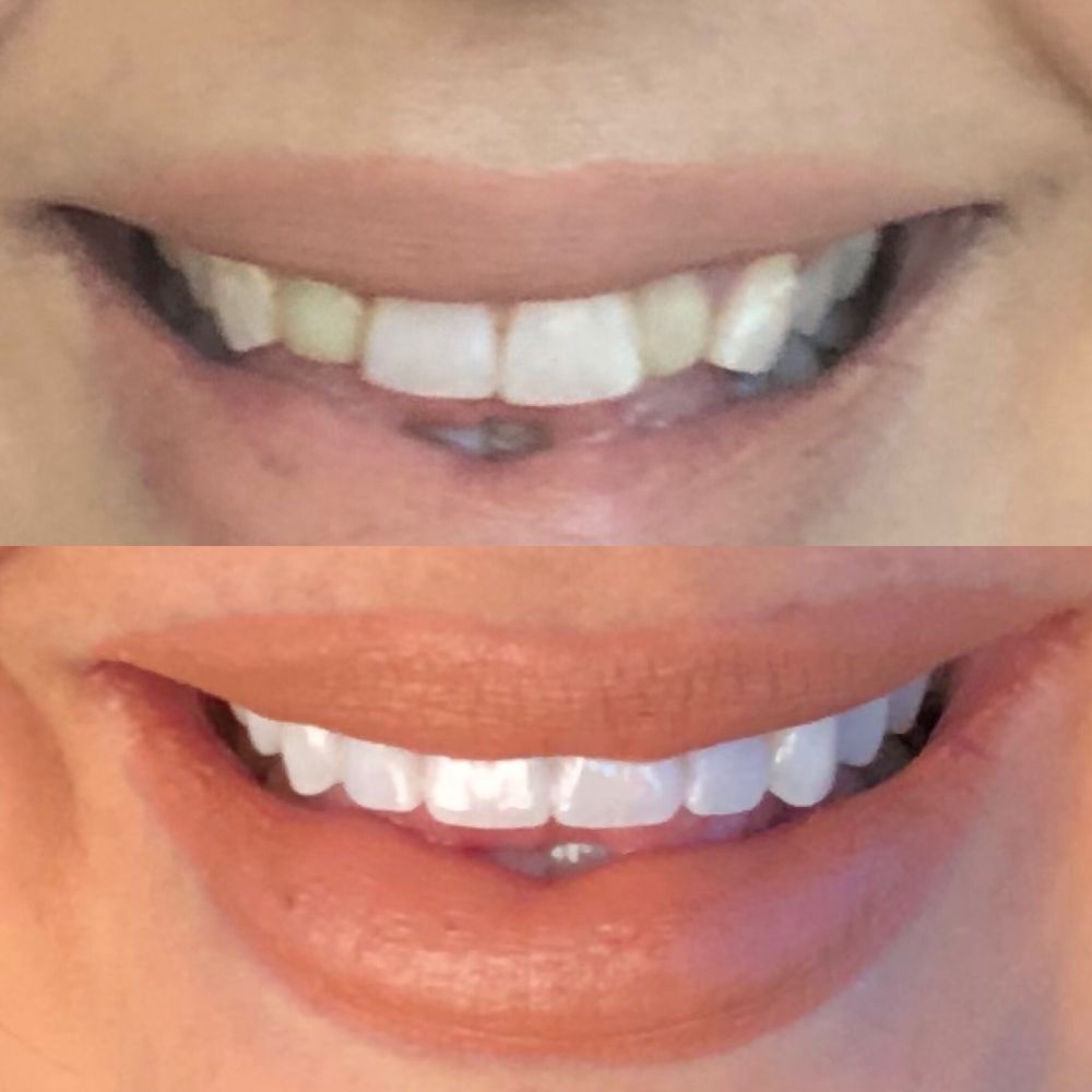 Spring Dental - General Dentistry Near Me - Bixby, Oklahoma Spring Dental - General Dentistry Near Me - Bixby, Oklahoma