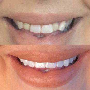 Spring Dental - General Dentistry Near Me - Bixby, Oklahoma Spring Dental - General Dentistry Near Me - Bixby, Oklahoma