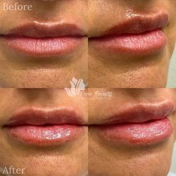 Pure Beauty Medical Spa