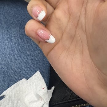 M Nails & Spa - The cut from the nail tech going too deep with the nippers - Waxing Near Me - Hayward, California M Nails & Spa - The cut from the nail tech going too deep with the nippers - Waxing Near Me - Hayward, California