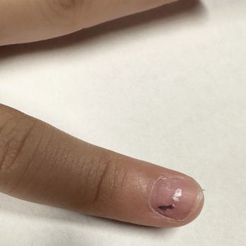 Eagle Nails Kahala - This was just 24 hrs later. - Nail Technicians Near Me - Honolulu, Hawaii