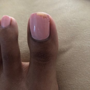 Sunflower Nails - GEL POLISH CHIPPED LESS THAN 24 HOURS LATER - Nail Salons Near Me - Alexandria, Virginia Sunflower Nails - GEL POLISH CHIPPED LESS THAN 24 HOURS LATER - Nail Salons Near Me - Alexandria, Virginia