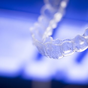 CISS Dental & Orthodontics - Invisalign Dentist - General Dentistry Near Me - Plano, Texas CISS Dental & Orthodontics - Invisalign Dentist - General Dentistry Near Me - Plano, Texas