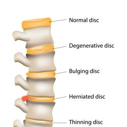 Arizona Pain Relief - Mesa - We Treat All Types Of Spine And Disc Conditions