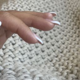 Too thick and painful because it's so thick. Nails aren't supposed to be thick like this. Too thick and painful because it's so thick. Nails aren't supposed to be thick like this.
