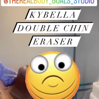Body Goals Studio - Kybella Double Chin Eraser - Medical Spas Near Me - Decatur, Georgia Body Goals Studio - Kybella Double Chin Eraser - Medical Spas Near Me - Decatur, Georgia