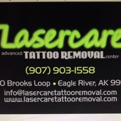 Lasercare Tattoo Removal - Lasercare Tattoo Removal uses the latest technology to remove unwanted ink without damaging your skin.