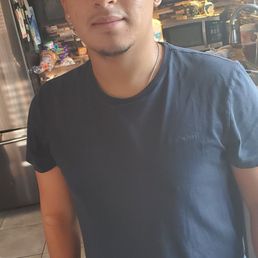 Here is my son Sammy the next day after his four wisdom teeth were removed no swelling! Here is my son Sammy the next day after his four wisdom teeth were removed no swelling!
