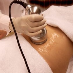 The Room - Faces & More - Non Surgical Liposuction