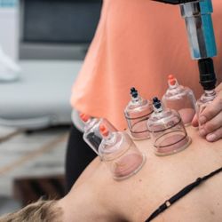 Thrive Proactive Health - Cupping works as a deep tissue technique to provide relief.
