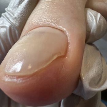 12 Nails Studio - Big toe nail - Nail Salons Near Me - Los Gatos, California 12 Nails Studio - Big toe nail - Nail Salons Near Me - Los Gatos, California