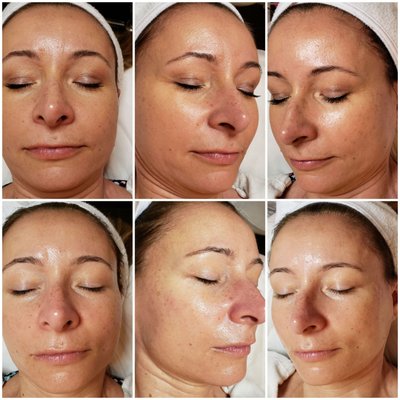 CRYSTAL PURE SKIN CARE - 465 Photos - 592 Ridge Rd, North Arlington