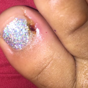 Neo Nails Brickell - I got a pedicure and the lady hurt me and this happened - Nail Salons Near Me - Miami, Florida Neo Nails Brickell - I got a pedicure and the lady hurt me and this happened - Nail Salons Near Me - Miami, Florida