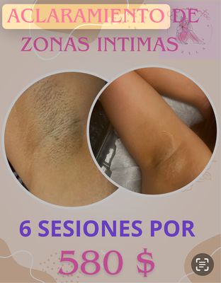 ✨ Waxing Services ✨ - Waxing Services Offered
✔️ Eyebrow Shaping
✔️ Lip & Chin
✔️ Full Face
✔️ Underarms
✔️ Arms (Half/Full)
✔️ Legs (Half/Full)
✔️ Bikini Line
✔️ Brazilian Wax
✔️ Back & Chest
✔️ Custom Packages Available
All services are performed with professional-grade wax and strict hygiene protocols.
Benefits of Waxing
✅ Long-lasting smoothness (3–6 weeks)
✅ Finer, softer regrowth over time
✅ No razor bumps or cuts
✅ Exfoliates dead skin cells for a healthy glow
✅ Less irritation compared to shaving
✅ Saves time in your daily routine
✅ Suitable for all skin tones and hair types ✨ Waxing Services ✨ - Waxing Services Offered
✔️ Eyebrow Shaping
✔️ Lip & Chin
✔️ Full Face
✔️ Underarms
✔️ Arms (Half/Full)
✔️ Legs (Half/Full)
✔️ Bikini Line
✔️ Brazilian Wax
✔️ Back & Chest
✔️ Custom Packages Available
All services are performed with professional-grade wax and strict hygiene protocols.
Benefits of Waxing
✅ Long-lasting smoothness (3–6 weeks)
✅ Finer, softer regrowth over time
✅ No razor bumps or cuts
✅ Exfoliates dead skin cells for a healthy glow
✅ Less irritation compared to shaving
✅ Saves time in your daily routine
✅ Suitable for all skin tones and hair types