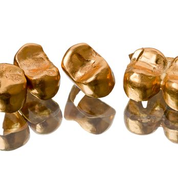 JewelRecycle - We buy dental gold - Gold Buyers Near Me - Chapel Hill, North Carolina JewelRecycle - We buy dental gold - Gold Buyers Near Me - Chapel Hill, North Carolina