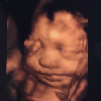 A Storks Studio - Ultrasound Imaging Centers Near Me - Farmington, Connecticut