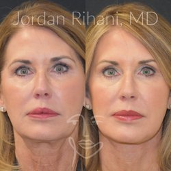 Facial Plastic Surgery Institute