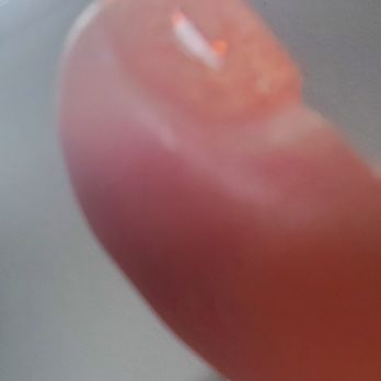 GoBahli Nails - This infection in 3 fingers had pus and blood coming from the sides of my nails. - Nail Salons Near Me - Carlsbad, California GoBahli Nails - This infection in 3 fingers had pus and blood coming from the sides of my nails. - Nail Salons Near Me - Carlsbad, California