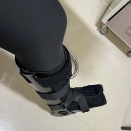 Broken metatarsal to my pinkie toe