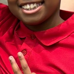 Kids Dental Smiles - Post 1st round of ortho treatment