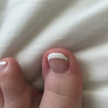 Glamour Nails - This picture is approximately 20 minutes after I left the salon....the other foot is just as bad! - Nail Salons Near Me - Carmel, Indiana