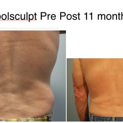 Aesthetic Surgery & Dermatology of Cherry Creek