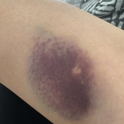Quest Diagnostics - Lab work less than 24hrs ago.