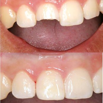 Robert E. Keating, DMD - Robert E. Keating, DMD - General Dentistry Near Me - Ventura, California Robert E. Keating, DMD - Robert E. Keating, DMD - General Dentistry Near Me - Ventura, California