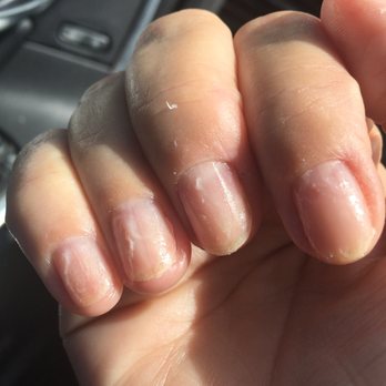 VIP Nails & Spa - Horrible Nail polish job, this is what it looked like 5 min after walking out of the shop. - Nail Salons Near Me - Brentwood, California VIP Nails & Spa - Horrible Nail polish job, this is what it looked like 5 min after walking out of the shop. - Nail Salons Near Me - Brentwood, California