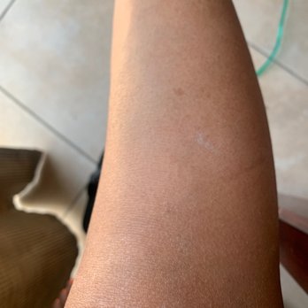 Royal Nail & Spa - Right knee, residue Royal Pedi. - Nail Salons Near Me - Rancho Cucamonga, California
