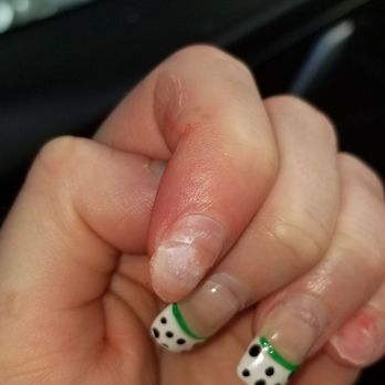 Sammi Nails Spa - Nails ripping off. How bad she cut me is shocking. It's so painful - Nail Salons Near Me - Mill Creek, Washington Sammi Nails Spa - Nails ripping off. How bad she cut me is shocking. It's so painful - Nail Salons Near Me - Mill Creek, Washington