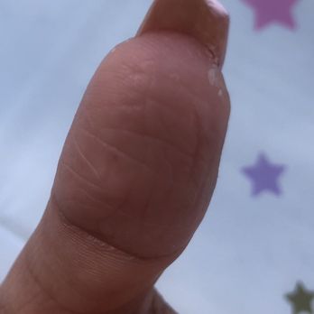 Nails By Long - They also did not bother to clean under the nail after applying the acrylic under my nail. - Nail Salons Near Me - San Diego, California Nails By Long - They also did not bother to clean under the nail after applying the acrylic under my nail. - Nail Salons Near Me - San Diego, California