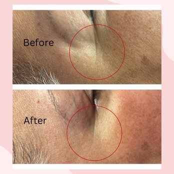 Chaton Salon - Before and after Express Facial - Waxing Near Me - Pinole, California