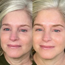 Before and after Before and after