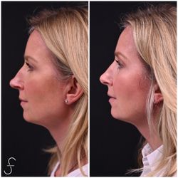 Shahin Fazilat, MD-SF Bay Area Plastic Surgery