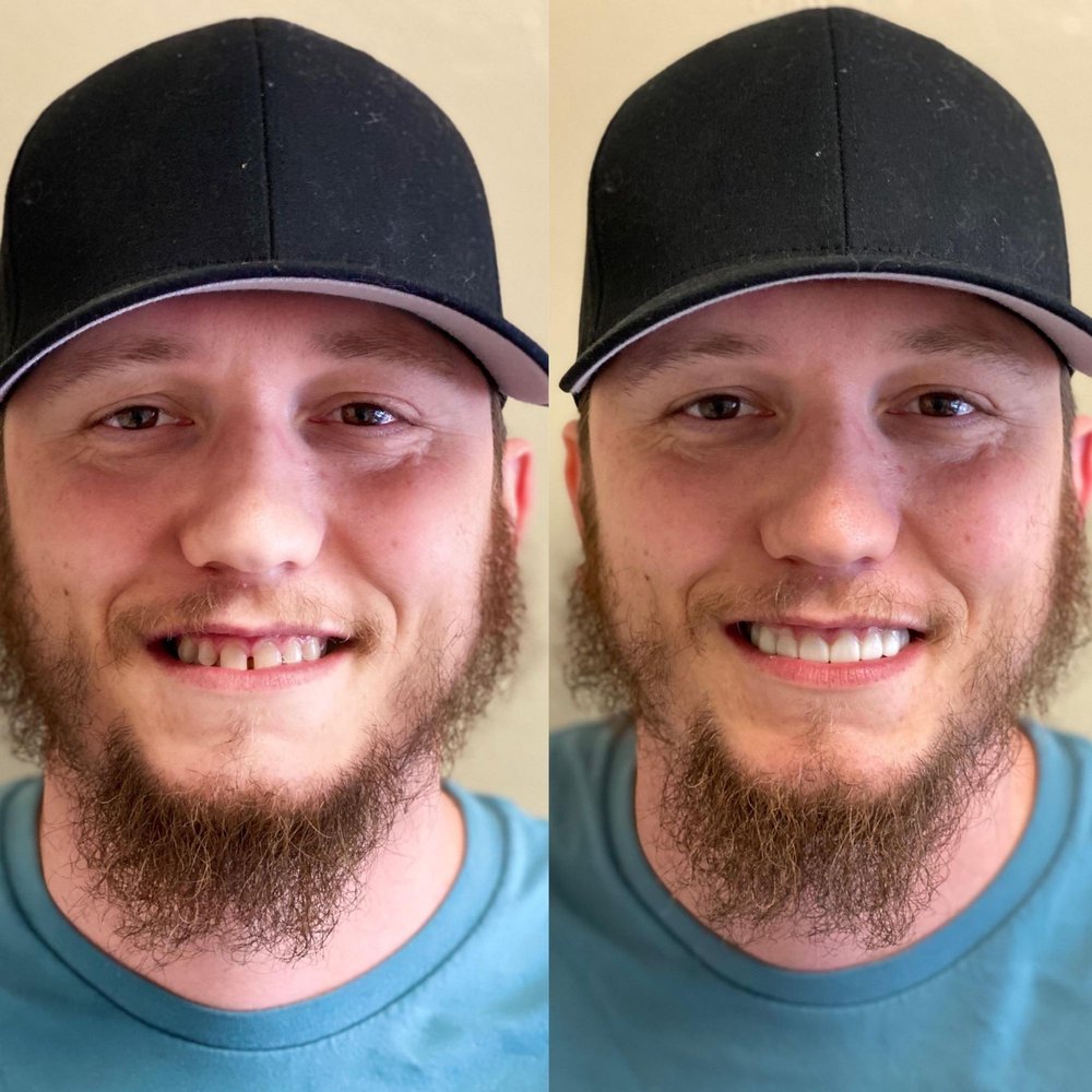 ALPHA DENTAL CARE Updated June 2024 19 Photos & 38 Reviews 1966 E