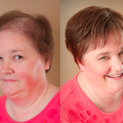 New Strands Hair Restoration