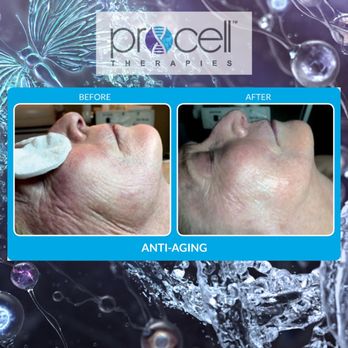 M Spa - Laser Hair Removal Near Me - Boise, Idaho M Spa - Laser Hair Removal Near Me - Boise, Idaho