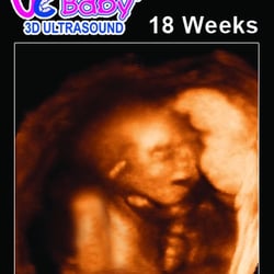 UC Baby - 3D Ultrasound