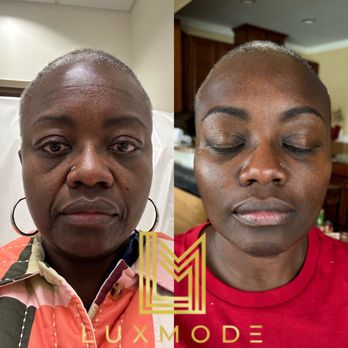 Luxmode Aesthetics & Wellness - Facial balancing with dermal fillers. Upper and lower face botox. - Medical Spas Near Me - Nottingham, Maryland Luxmode Aesthetics & Wellness - Facial balancing with dermal fillers. Upper and lower face botox. - Medical Spas Near Me - Nottingham, Maryland