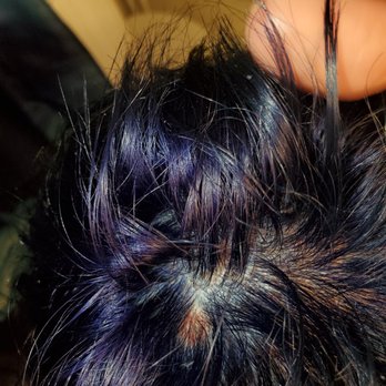 The Ultimate Salon  - Chemical burns - Waxing Near Me - La Crosse, Wisconsin