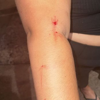 Turnbull's Tavern - My arm not including the cuts on my ankle - American Near Me - Whittier, California Turnbull's Tavern - My arm not including the cuts on my ankle - American Near Me - Whittier, California