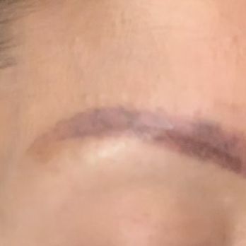 Mybrows Studio & Academy - Fast forward after a few removals with Annie. This was a bad job and ink. Removal should not be this difficult. - Permanent Makeup Near Me - Rancho Cucamonga, California Mybrows Studio & Academy - Fast forward after a few removals with Annie. This was a bad job and ink. Removal should not be this difficult. - Permanent Makeup Near Me - Rancho Cucamonga, California