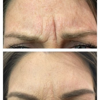 Creole Contour Aesthetics - Neurotoxin, Botox, Jeuveau - Aestheticians Near Me - Cypress, Texas Creole Contour Aesthetics - Neurotoxin, Botox, Jeuveau - Aestheticians Near Me - Cypress, Texas