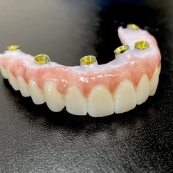Pacific Smilekrafters - Fixed Implant Teeth by Dr. Parmar